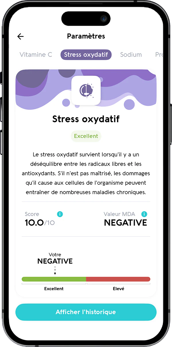 Stress Oxydatif